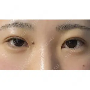 湘南美容クリニック 湘南美容クリニック 池袋東口院口コミ