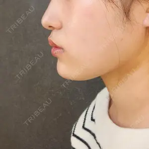 口コミ