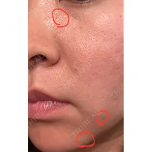 Mavie Beauty Clinic （マヴィービューティークリニック）口コミ