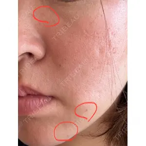 Mavie Beauty Clinic （マヴィービューティークリニック）口コミ