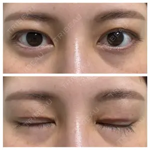 湯田クリニック 銀座口コミ