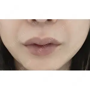 口コミ