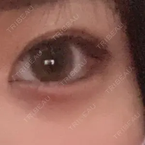 AI Beauty Clinic （エーアイ美容クリニック）口コミ