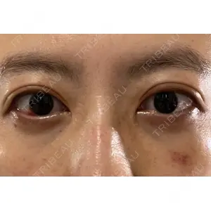 APOLLO BEAUTY CLINIC口コミ