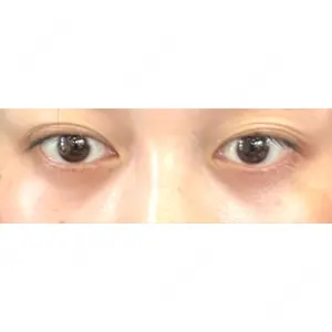 APOLLO BEAUTY CLINIC口コミ