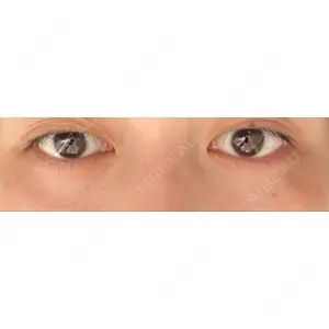 APOLLO BEAUTY CLINIC口コミ