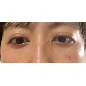 APOLLO BEAUTY CLINIC口コミ