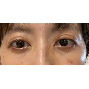 APOLLO BEAUTY CLINIC口コミ