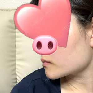ビューティースキンクリニック ビューティースキンクリニック 池袋院口コミ