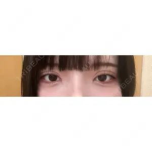 湘南美容クリニック 湘南美容クリニック 池袋東口院口コミ