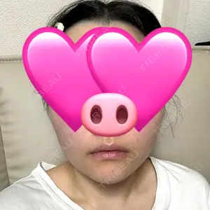 ビューティースキンクリニック ビューティースキンクリニック 池袋院口コミ