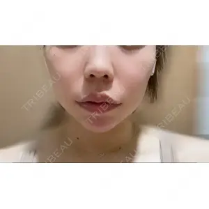 口コミ
