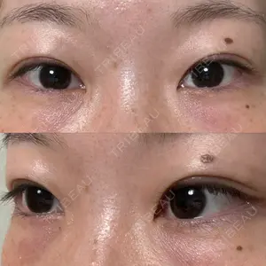 口コミ