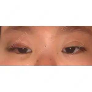 口コミ