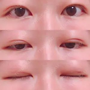 湘南美容クリニック 湘南美容クリニック 東京蒲田院口コミ