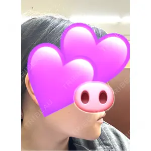 ビューティースキンクリニック ビューティースキンクリニック 池袋院口コミ
