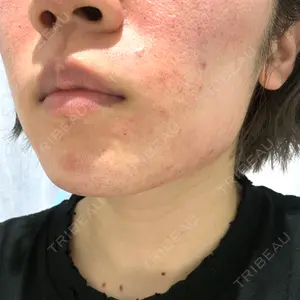 Tokyo Tensei Clinic Tokyo Tensei Clinic 銀座院口コミ