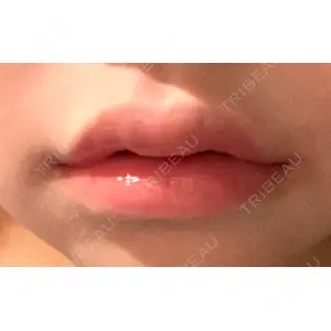 L‘amour clinic Tokyo【ラムールクリニック東京】口コミ