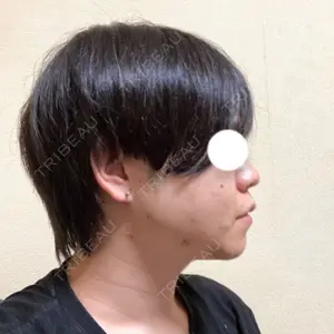 セギム美容整形外科口コミ