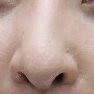 渋谷の森クリニック口コミ
