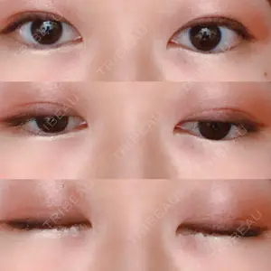 湘南美容クリニック 湘南美容クリニック 東京蒲田院口コミ