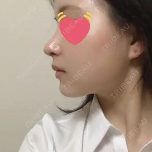 HANABI整形外科口コミ