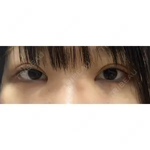口コミ