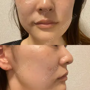 東京美容外科の口コミ