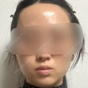 TCB東京中央美容外科の口コミ