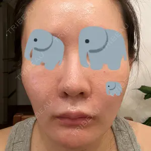 ミニマムスキンクリニック ミニマムスキンクリニック池袋口コミ