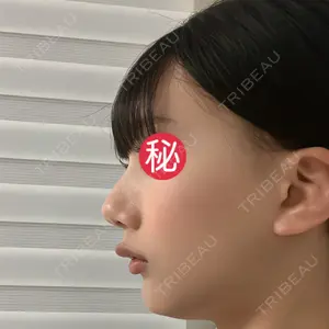 ヒューマン美容外科の