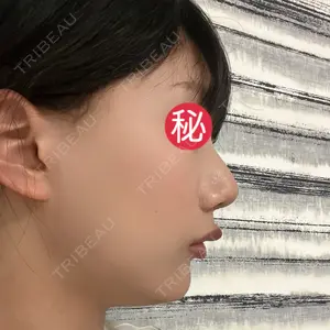 ヒューマン美容外科の