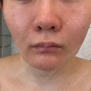 ミニマムスキンクリニック ミニマムスキンクリニック池袋口コミ