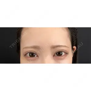 藤・ナチュレ美容クリニック 藤・ナチュレ美容クリニック 銀座院口コミ