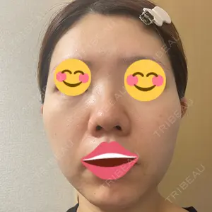 DAILY SKIN CLINIC 福岡院口コミ