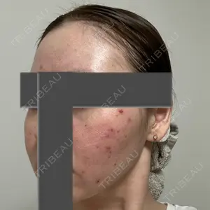 東京美容外科 東京美容外科 池袋院口コミ