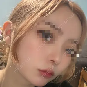 LUHO（ルホ）美容外科口コミ