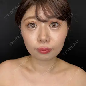 藤・ナチュレ美容クリニック 藤・ナチュレ美容クリニック 銀座院口コミ