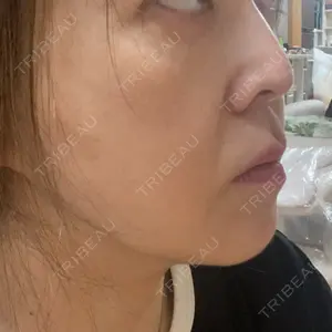 CHARIS BEAUTY CLINIC口コミ