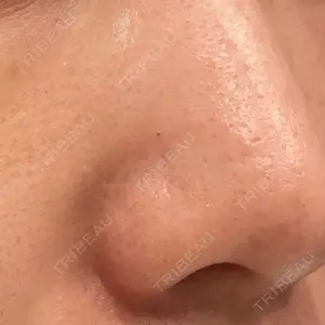 9BeautyClinic口コミ