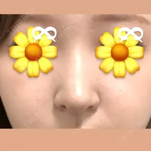 LUHO（ルホ）美容外科口コミ