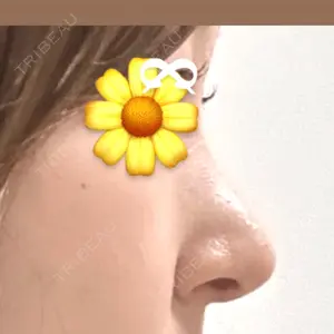 LUHO（ルホ）美容外科口コミ