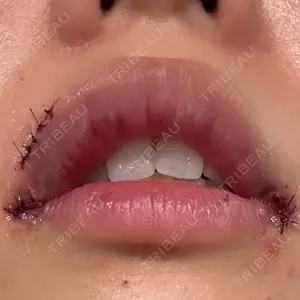 口コミ