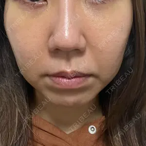 口コミ