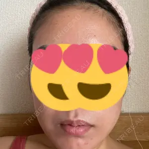 9BeautyClinic口コミ