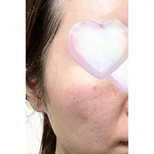 Re:anne clinic 銀座 【リアンクリニック銀座】口コミ