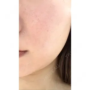 Re:anne clinic 銀座 【リアンクリニック銀座】口コミ