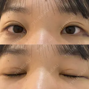 口コミ