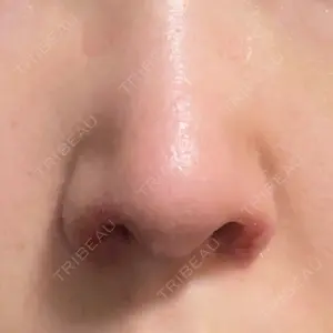 GLANZ CLINIC口コミ