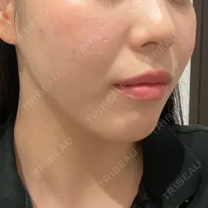 R Beauty CLINIC R Beauty CLINIC 大阪院口コミ